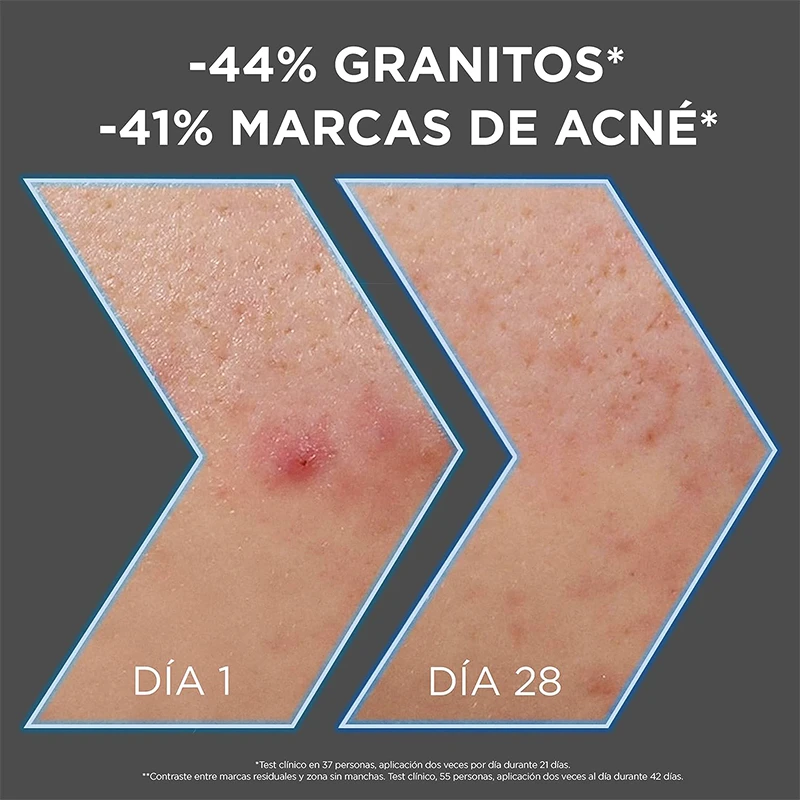 قیمت سرم زغال روشن کننده AHA + BHA نیاسینامید گارنیر اصل