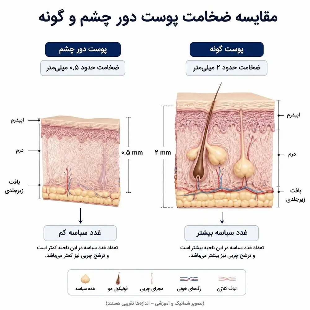 مقایسه ضخامت پوست دور چشم و تراکم غدد سباسه با سایر نواحی صورت