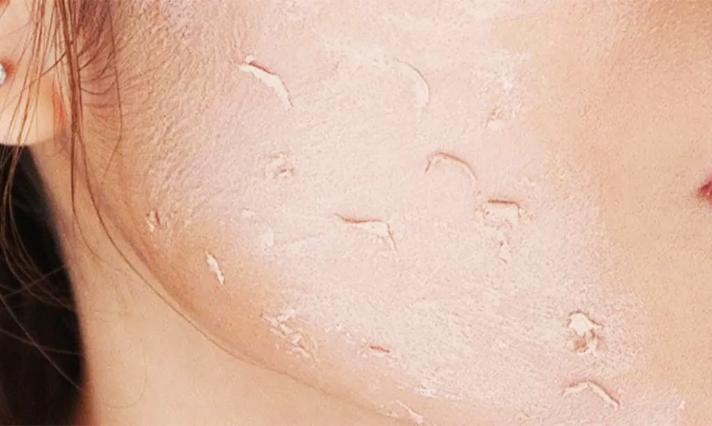 پیل شدن ضد آفتاب چیست؟